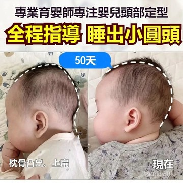 🔥臺灣出貨 嬰兒定型枕 新生兒0-3個月到1嵗圓頭枕頭 寶寶糾矯正頭型神器 嬰兒定型枕 防偏頭定型枕 新生兒枕 凹洞枕