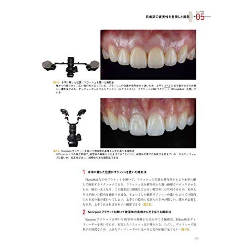 魅せるプレゼンテーションのための歯科臨床写真の撮り方