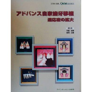 アドバンス自家歯牙移植 適応症の拡大 別冊ザ・クインテッセンス２０００／月星光博(編者),宮崎正憲(編者)