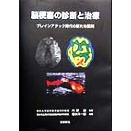 脳梗塞の診断と治療 ブレインアタック時代の新たな展開／橋本洋一郎(著者),内野誠