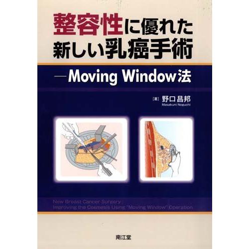 [A12010669]整容性に優れた新しい乳癌手術