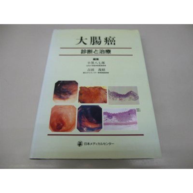 大腸癌?診断と治療