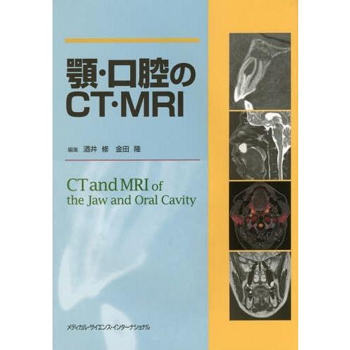 顎・口腔のCT・MRI