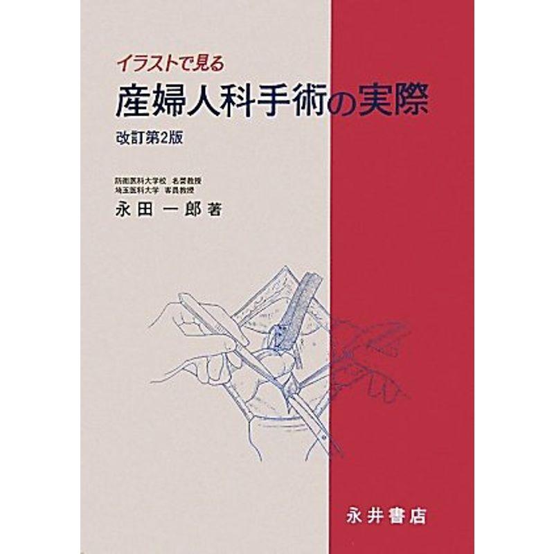 イラストで見る産婦人科手術の実際