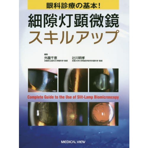 眼科診療の基本 細隙灯顕微鏡スキルアップ