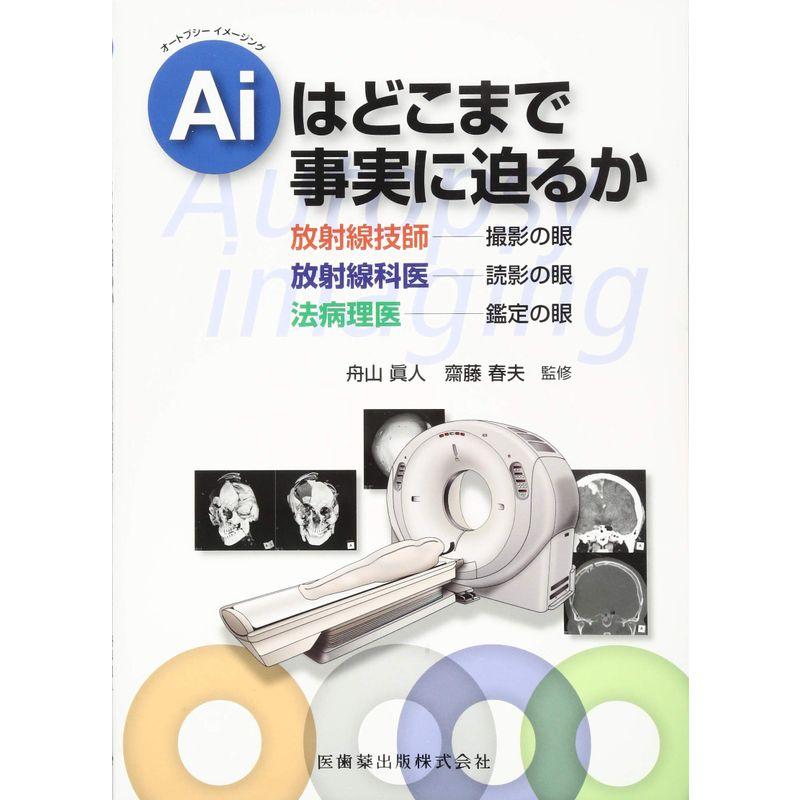 オートプシーイメージング Aiはどこまで事実に迫るか