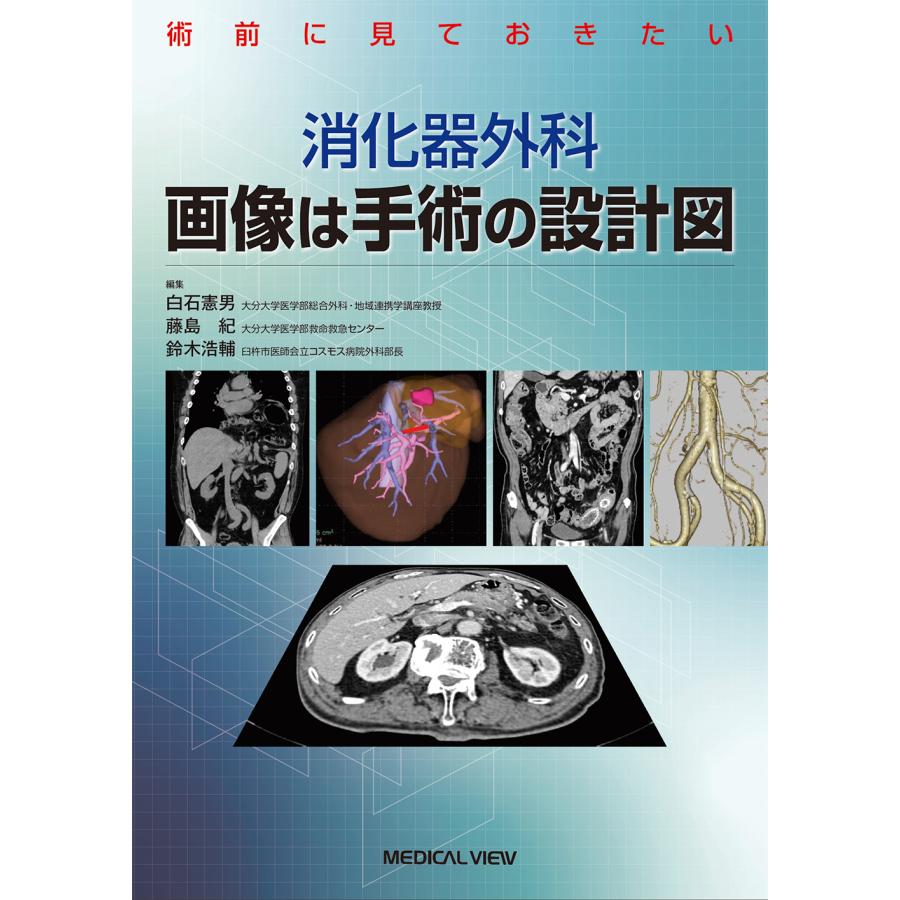 消化器外科画像は手術の設計図 術前に見ておきたい