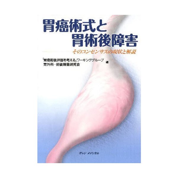 胃癌術式と胃術後障害 そのコンセンサスの現状と解説