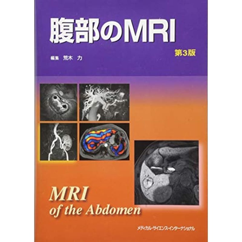 腹部のMRI 第3版