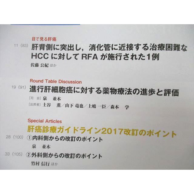 UB25-122 メジカルビュー社 The LIVER CANCER JOURNAL 進行肝細胞癌に対する薬物療法の進歩と評価 2018年9月号 04s3A