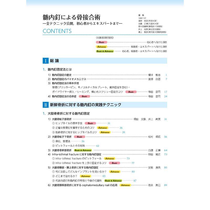 髄内釘による骨接合術 ー全テクニック公開,初心者からエキスパートまでー