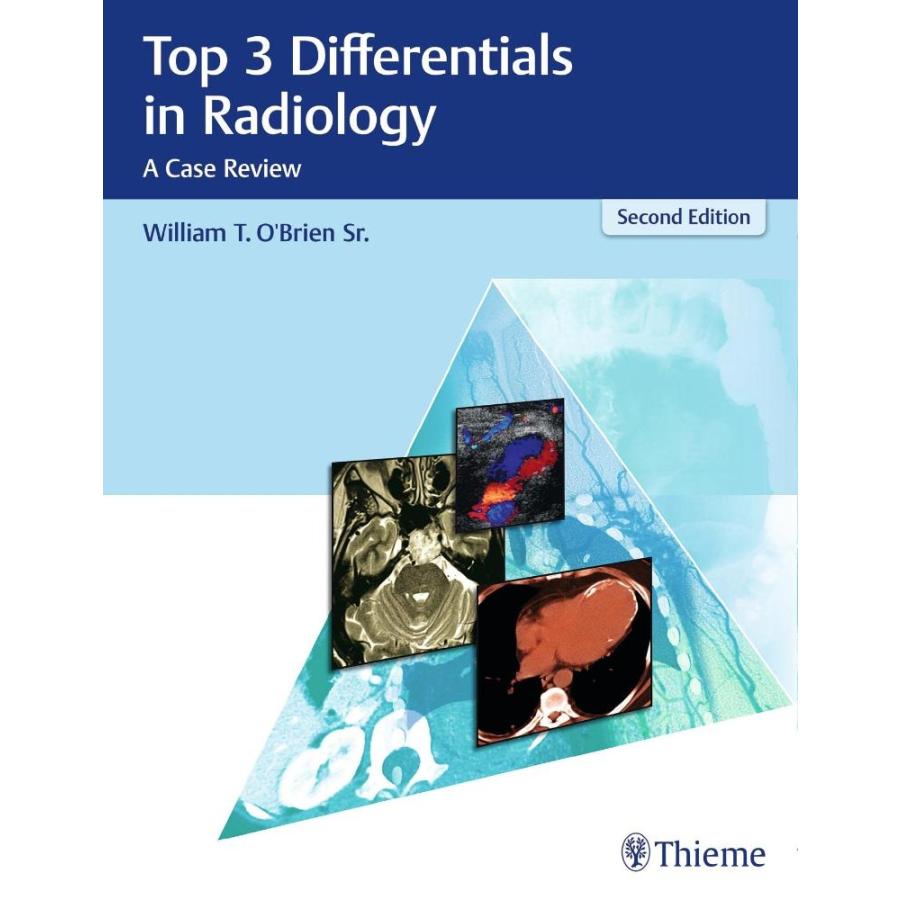 Top Differentials in Radiology: A Case Review