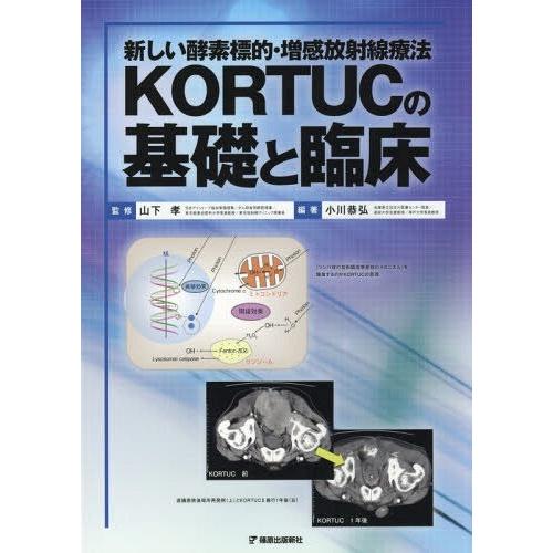 新しい酵素標的・増感放射線療法KORTUCの基礎と臨床