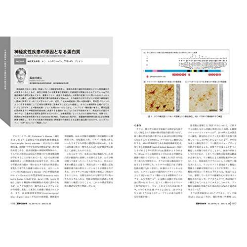 医学のあゆみ 蛋白質代謝医学 構造・機能の研究から臨床応用まで 2018年