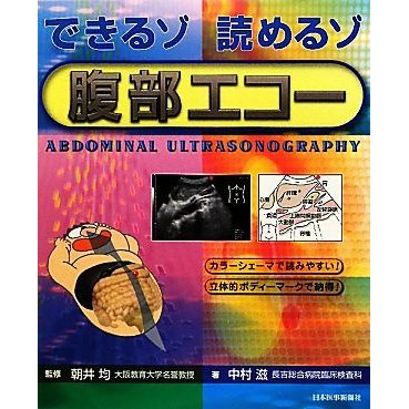 できるゾ読めるゾ　腹部エコー／朝井均，中村滋