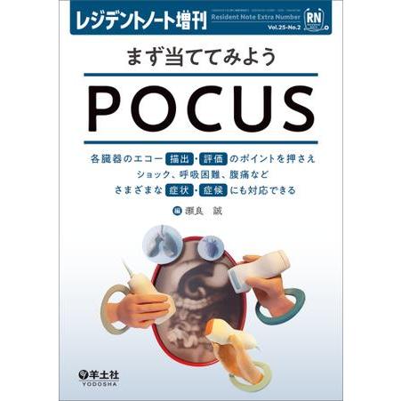 まず当ててみようPOCUS