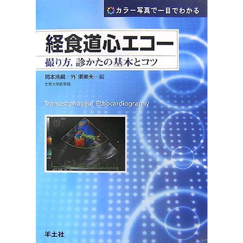 経食道心エコー?撮り方、診かたの基本とコツ カラー写真で一目でわかる