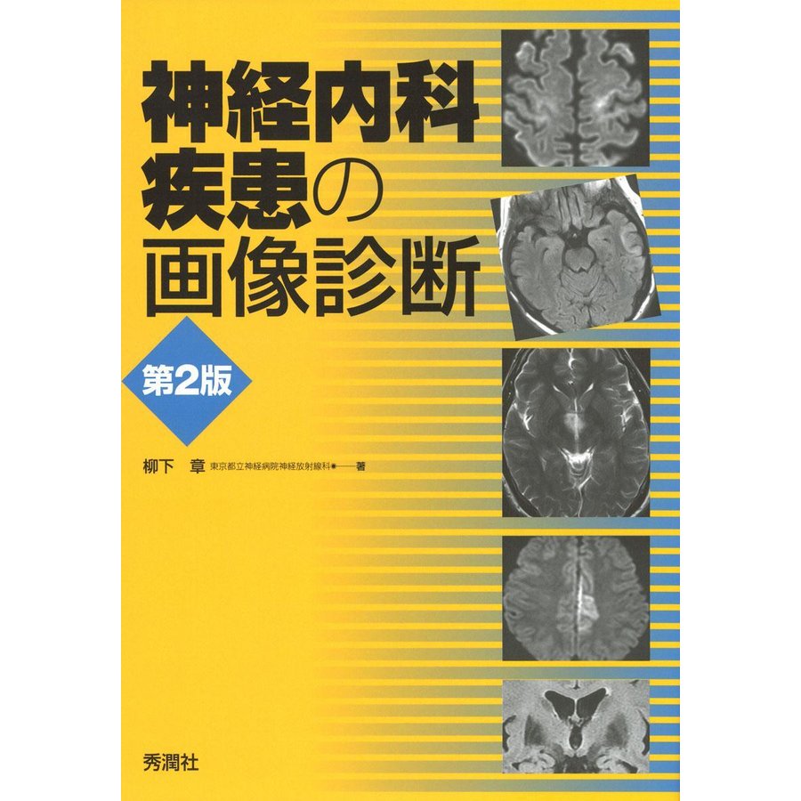 神経内科疾患の画像診断