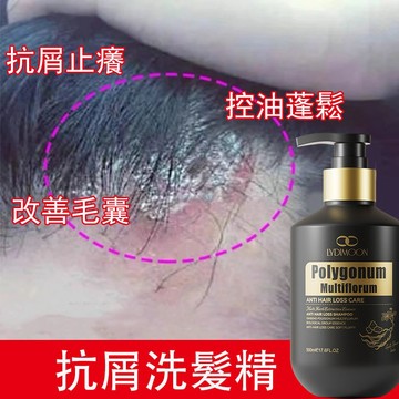 【台灣現貨】止癢洗髮精 抗屑洗髮精 草本控油洗髮精 止癢抗屑 頭皮調理 頭皮屑 清潔毛囊 強健髮根 減少乾枯500ml