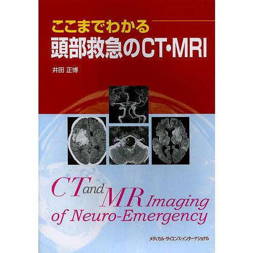 ここまでわかる頭部救急のCT・MRI 井田正博