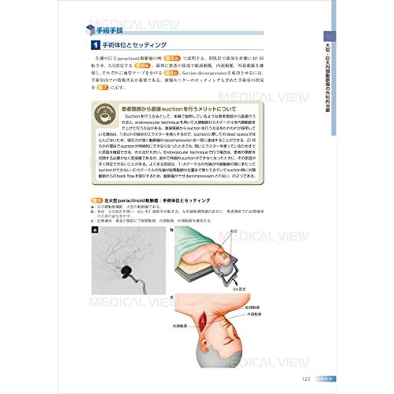 脳動脈瘤−専門医になるための基本ポイント (新NS NOW 17)