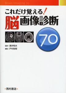 これだけ覚える 脳画像診断70