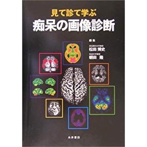 痴呆の画像診断―見て診て学ぶ