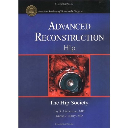 Advanced Reconstruction Hip (Advanced Reconstruction S)