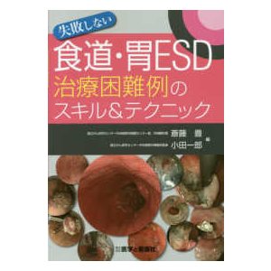 失敗しない食道・胃ＥＳＤ治療困難例のスキル＆テクニック