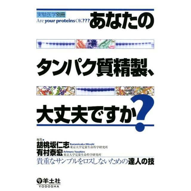 あなたのタンパク質精製,大丈夫ですか ~貴重なサンプルをロスしないための達人の技