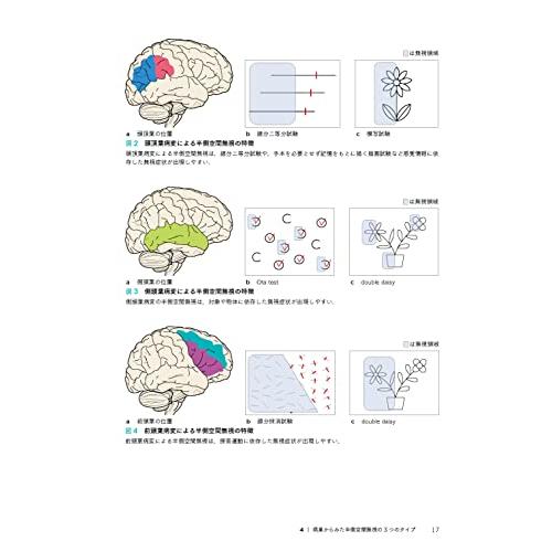 臨床で使える 半側空間無視への実践的アプローチ