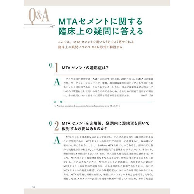 MTAを用いたエンドの臨床 予知性の高いバイオセラミックマテリアルの応用法