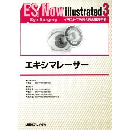 エキシマレーザー ＥＳ　Ｎｏｗ　ｉｌｌｕｓｔｒａｔｅｄｎｏ．３イラストでみる今日の眼科手術３／メディカル