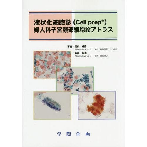 液状化細胞診 婦人科子宮頸部細胞診アトラス