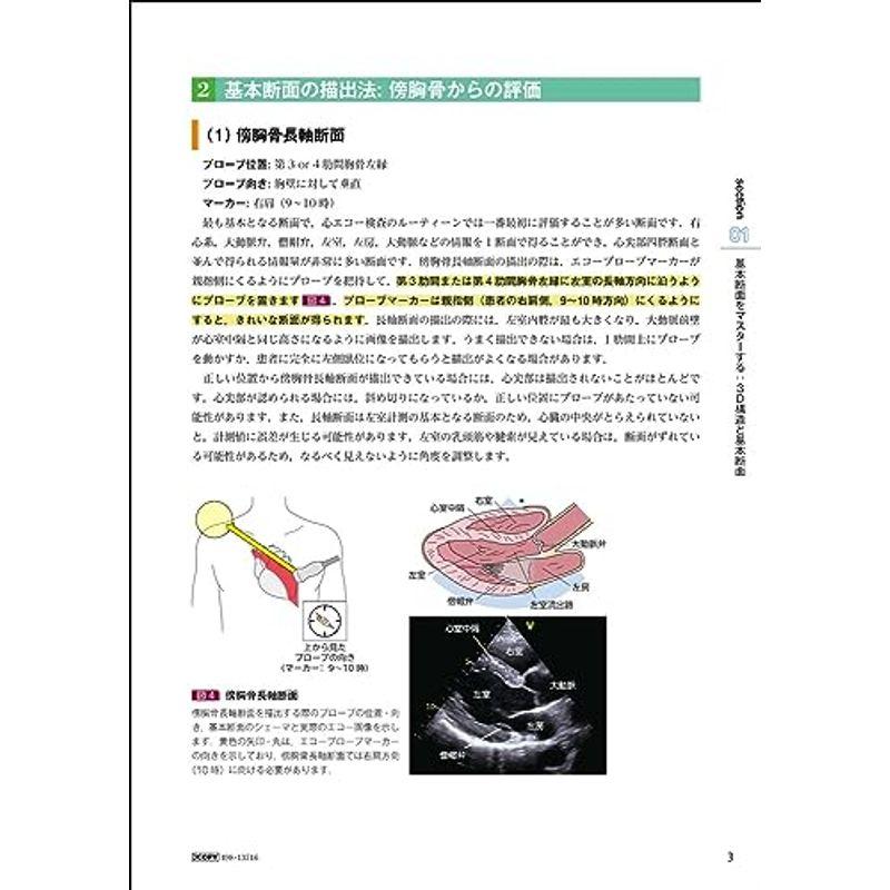 若手心エコーフェローが教える心エコーのみかた