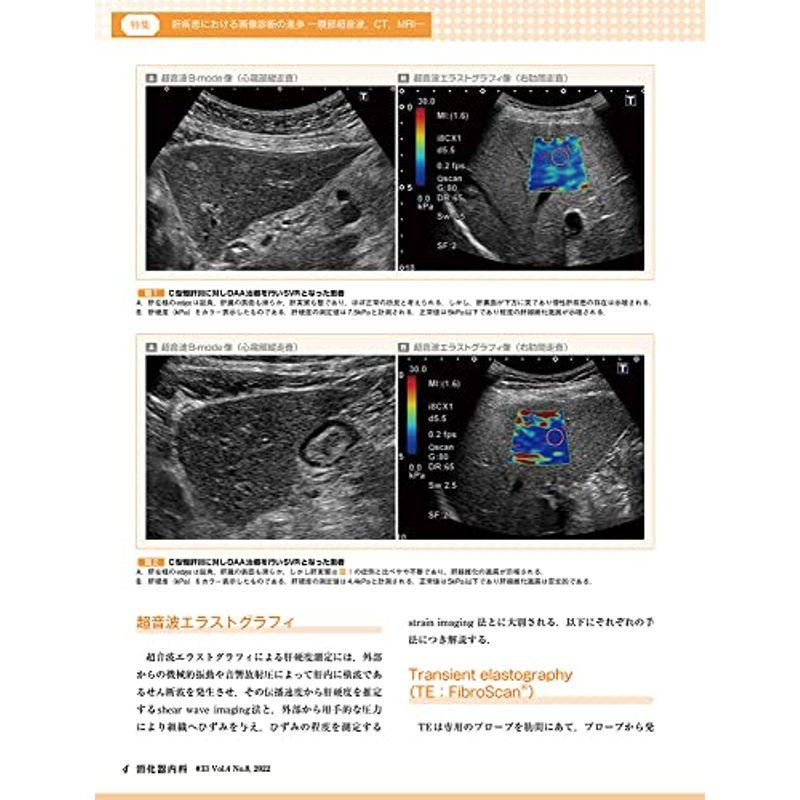 消化器内科 第33号(Vol.4 No.8,2022)特集:肝疾患における画像診断の進歩 ?腹部超音波,CT,MRI?