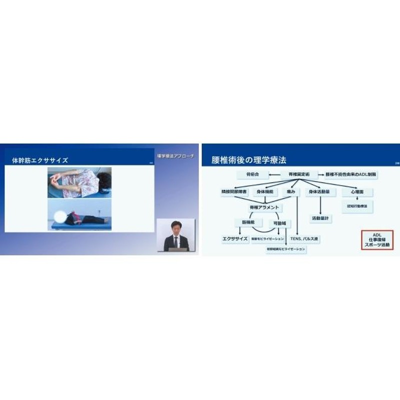 腰痛変性疾患術後の理学療法ガイド ジャパンライム - sorbillomenu.com