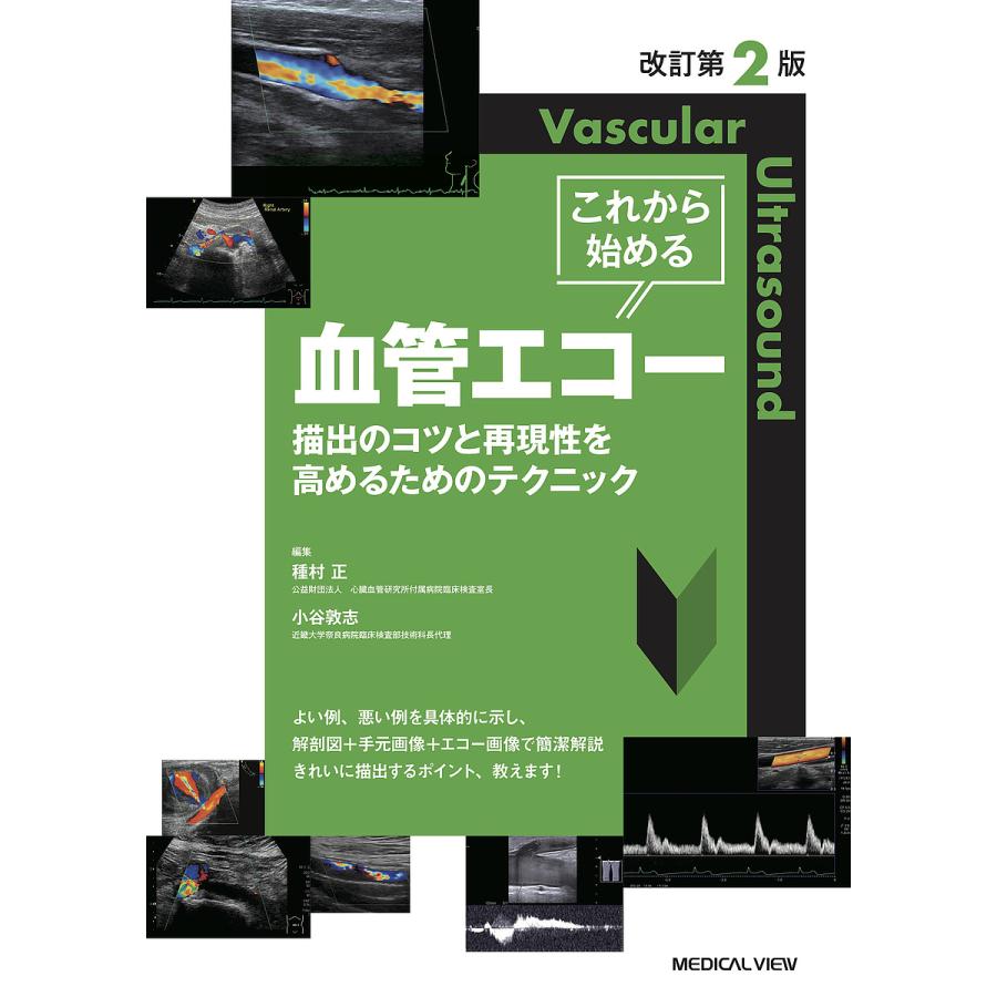 改訂第2版 これから始める血管エコー