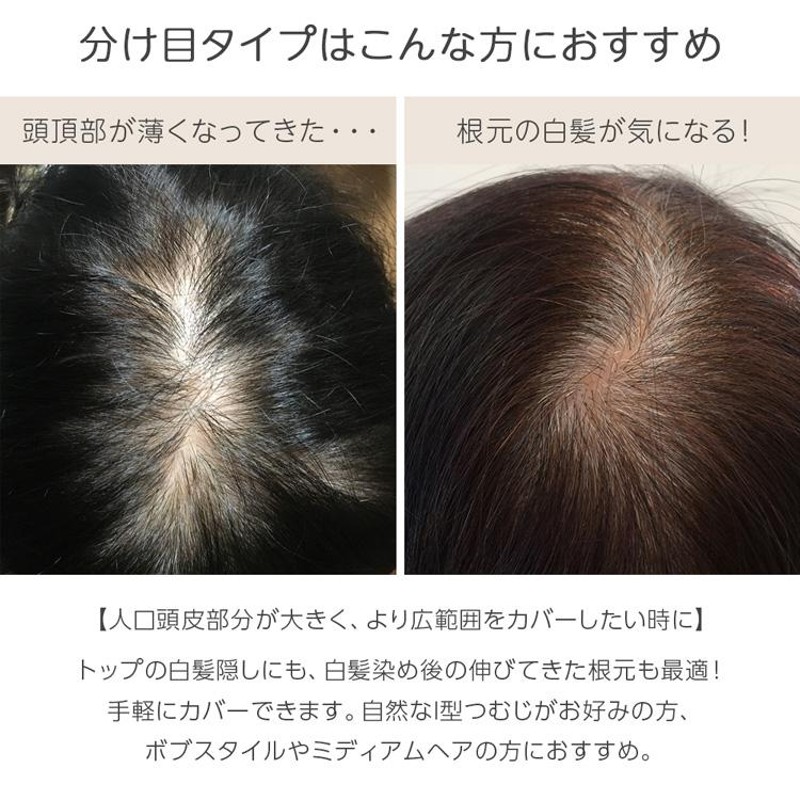 ヘアピース 人毛100% 人毛 100 ウィッグ トップカバー 部分ウィッグ ...