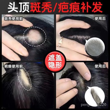 【優選精品】疤痕補髮貼斑禿頭部傷疤頭頂隱形假髮貼片無痕真髮絲生物頭皮男女ins日韓風 TUJV