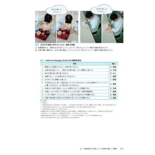 臨床で使える 半側空間無視への実践的アプローチ