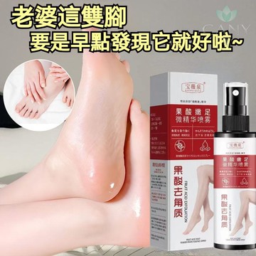 ✨隔日達【重塑足部柔嫩肌】素秀臣氏果酸足部噴霧 清爽好吸收 軟化角質嫩膚 腳後跟 腳皮軟化腳底去死皮噴霧 果酸噴霧