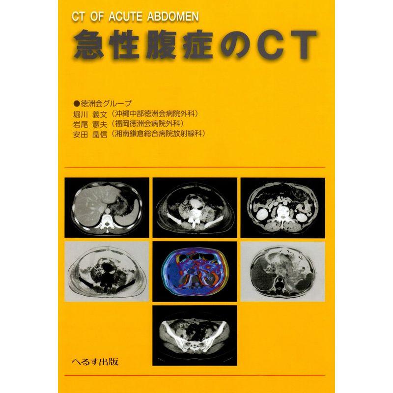 急性腹症のCT