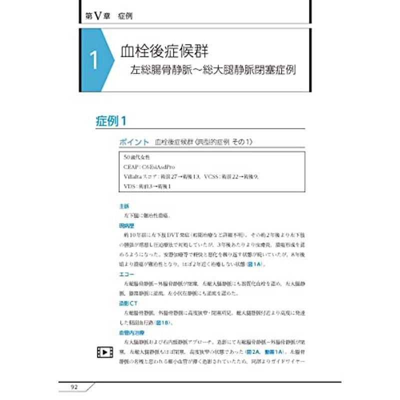 慢性深部静脈不全の評価と治療 -動画を含む電子版付-