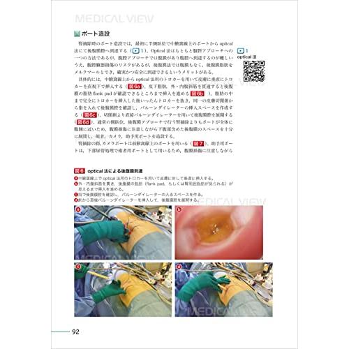 究める 腎・副腎腫瘍に対する腹腔鏡・ロボット支援手術