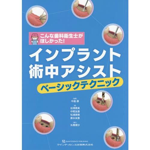 インプラント術中アシストベーシックテクニック こんな歯科衛生士がほしかった