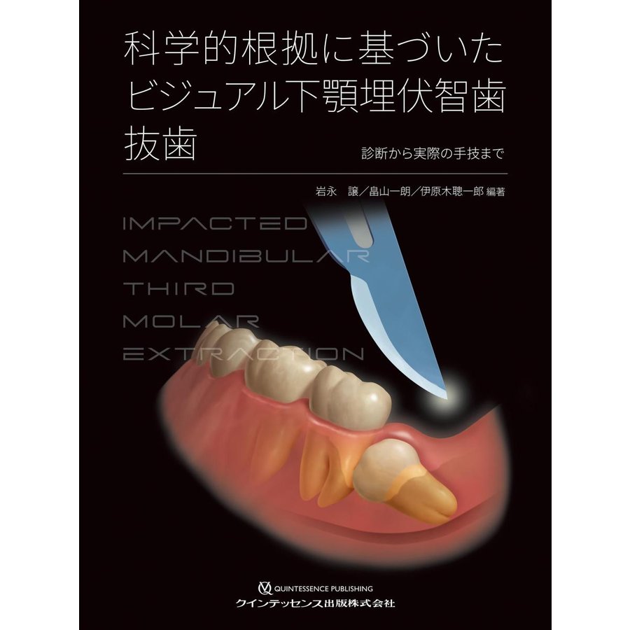 科学的根拠に基づいた ビジュアル下顎埋伏智歯抜歯