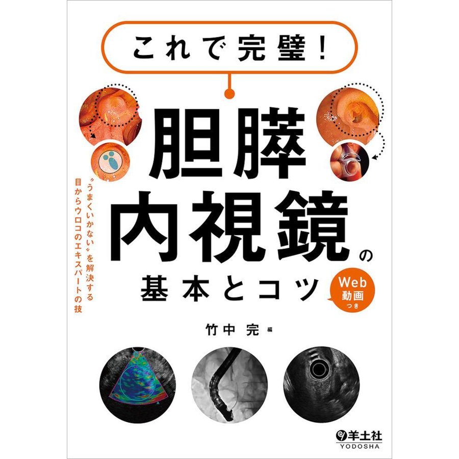 これで完璧!胆膵内視鏡の基本とコツ-゛うまくいかない゛を解決する目からウロコのエ　LINEショッピング