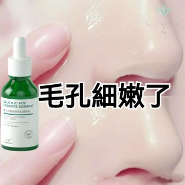 ✨隔日達【果酸煥膚黑科技】臻羞水楊酸精華液 收縮毛孔 細緻肌膚 舒緩保濕 深層清潔 毛孔粗大黑頭粉刺痘印可用 果酸精華液