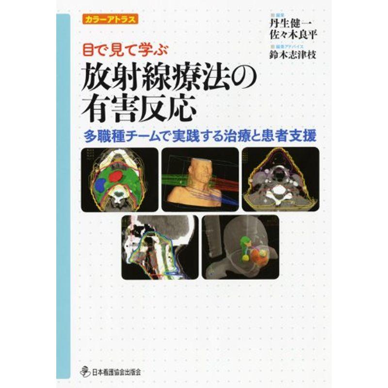 放射線療法の有害反応?カラーアトラス目で見て学ぶ